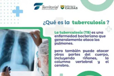 Las cifras de tuberculosis en Caldas en los úlitmos meses reflejan una distribución preocupante de la enfermedad en varias zonas del departamento. Así lo alerta la Dirección Territorial de Salud. 
